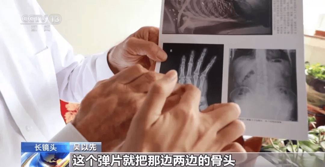 皇冠信用盘可以占几成
_“老先生皇冠信用盘可以占几成
，您把项链取下来再做CT”